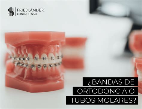 brackets bandas metalicas|bandas de ortodoncia función.